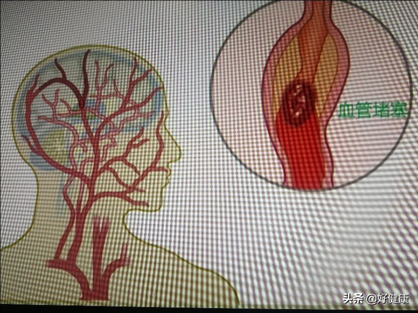 今日科普一下！吃宵夜昏迷8个月去世,百科词条爱好_2024最新更新