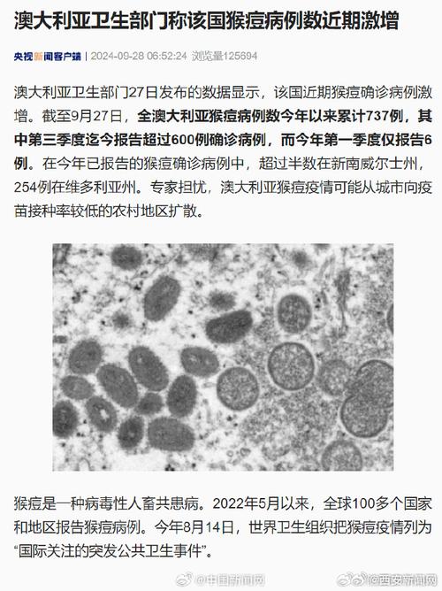 今日科普一下！4人亲密接触染猴痘,百科词条爱好_2024最新更新