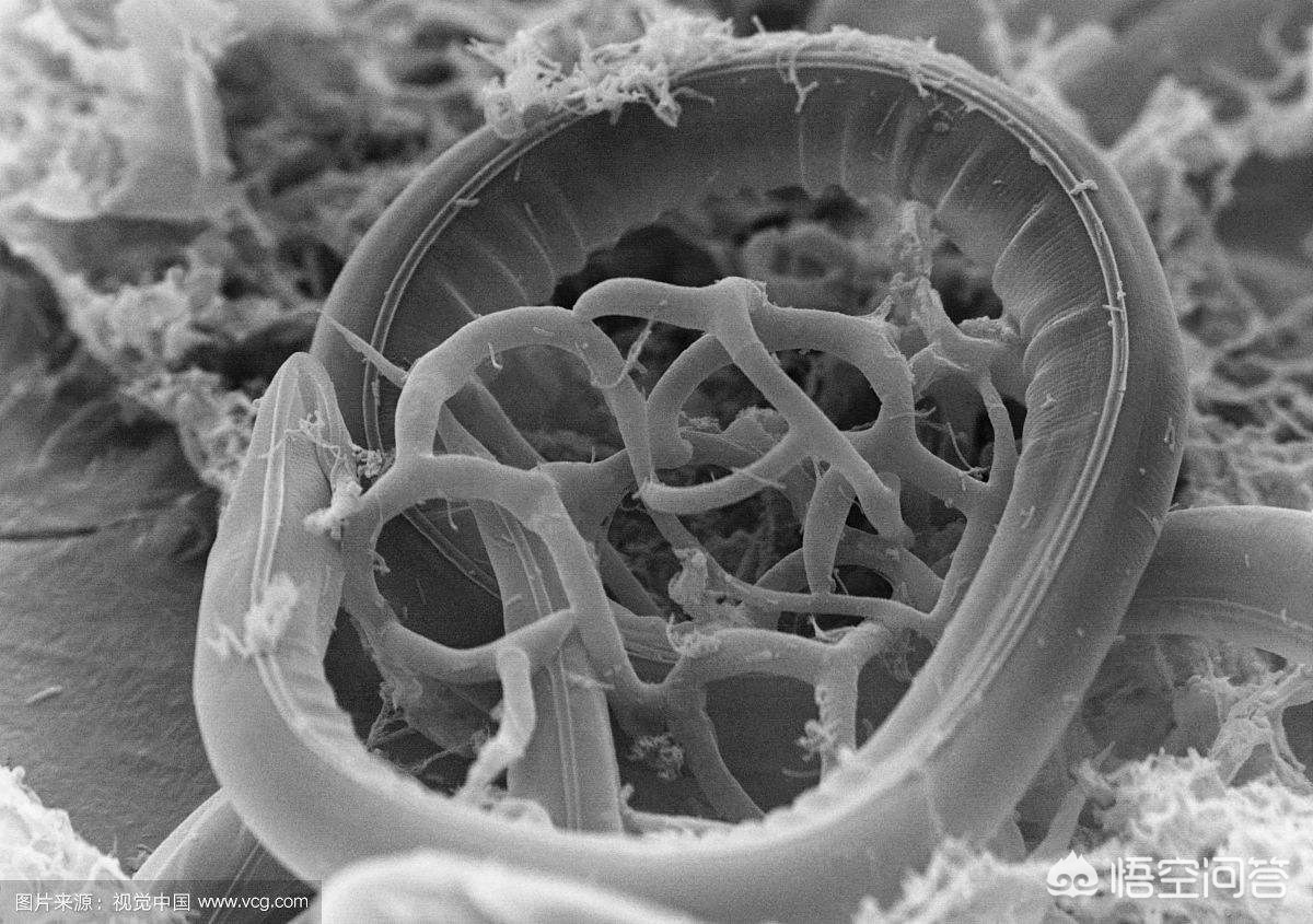 今日科普一下！体内排出2.73米绦虫,百科词条爱好_2024最新更新